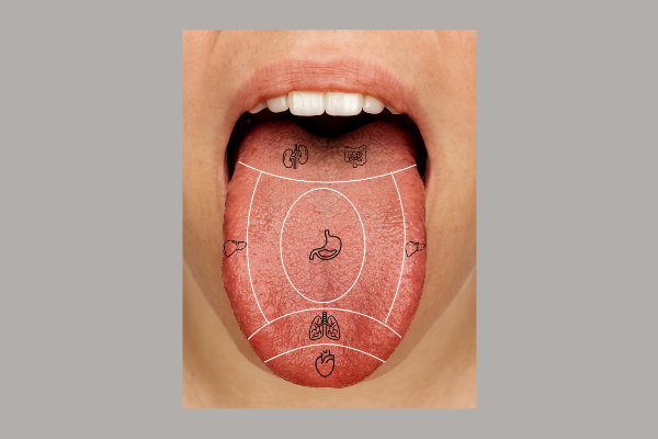 langue schéma 600x400 cartographie de la langue